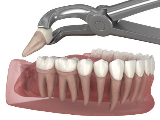 麻坡 Sunrise Dental 智慧牙手术服务示意图