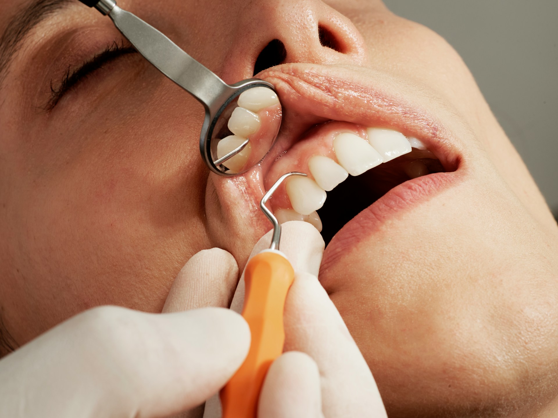 麻坡 Sunrise Dental 牙科检查器械